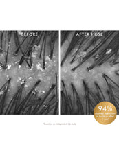 Load image into Gallery viewer, Before and after comparison of hair follicles with a product application, showing 94% reduction in buildup.
